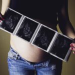 woman holding ultrasound results