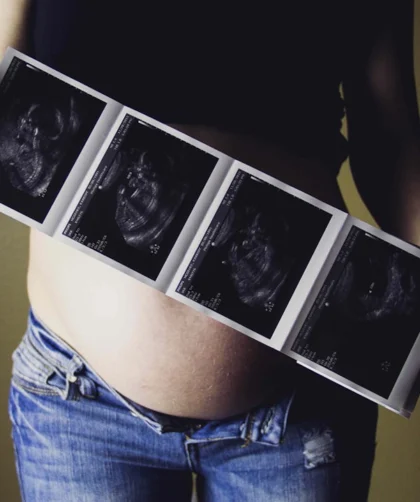 woman holding ultrasound results